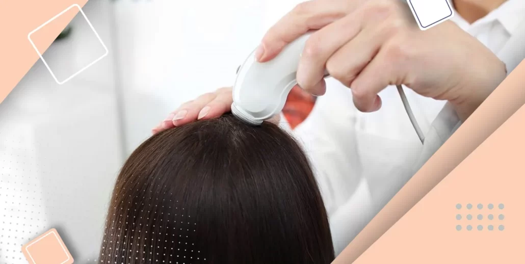تفاوت بین روش های کاشت مو در زنان و مردان