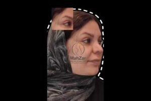 -ابرو-با-تراکم-و-خواب-مناسب-poster