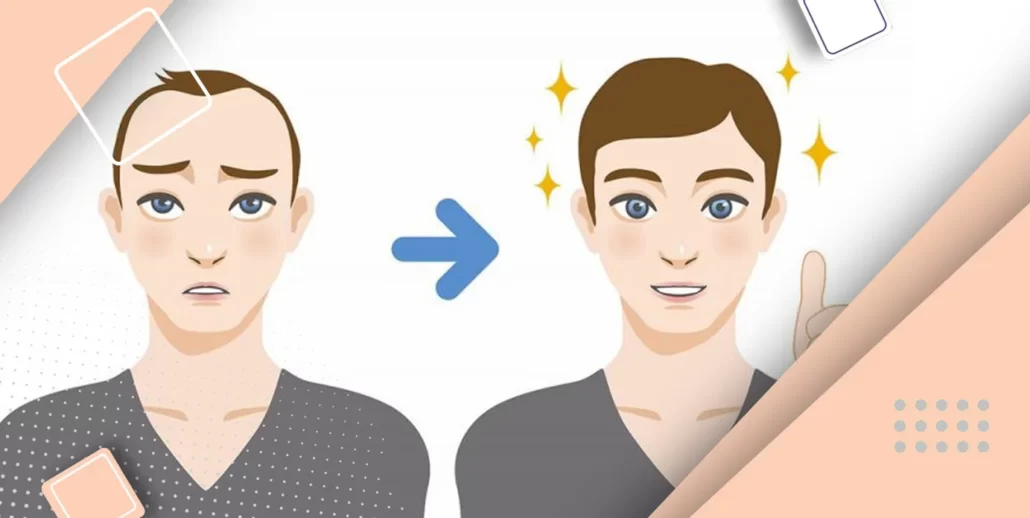 حقیقت هزینه کاشت مو چیست؟