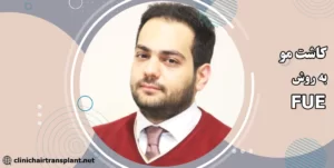کاشت مو به روش fue