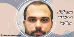 کاشت مو