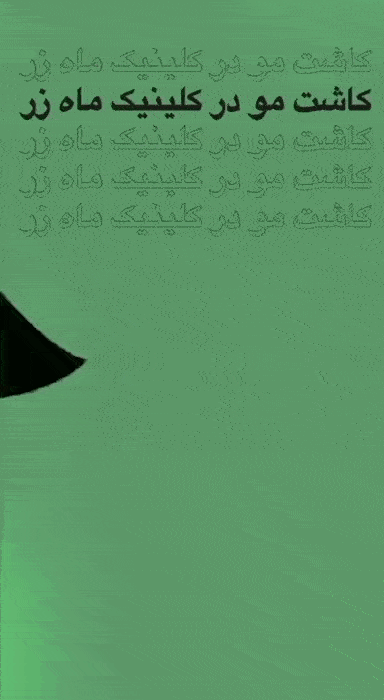fit یا کاشت مو میکروگرافت؟