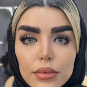 بعد ابرو کاشت