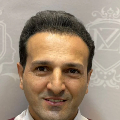 بعد از کاشت موی