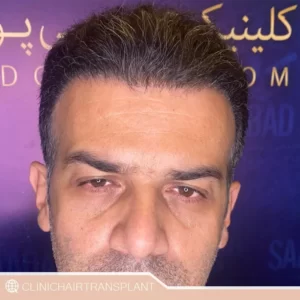 موی نرم آقایان