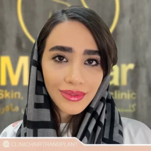 کاشت ابرو در چند جلسه انجام میشود