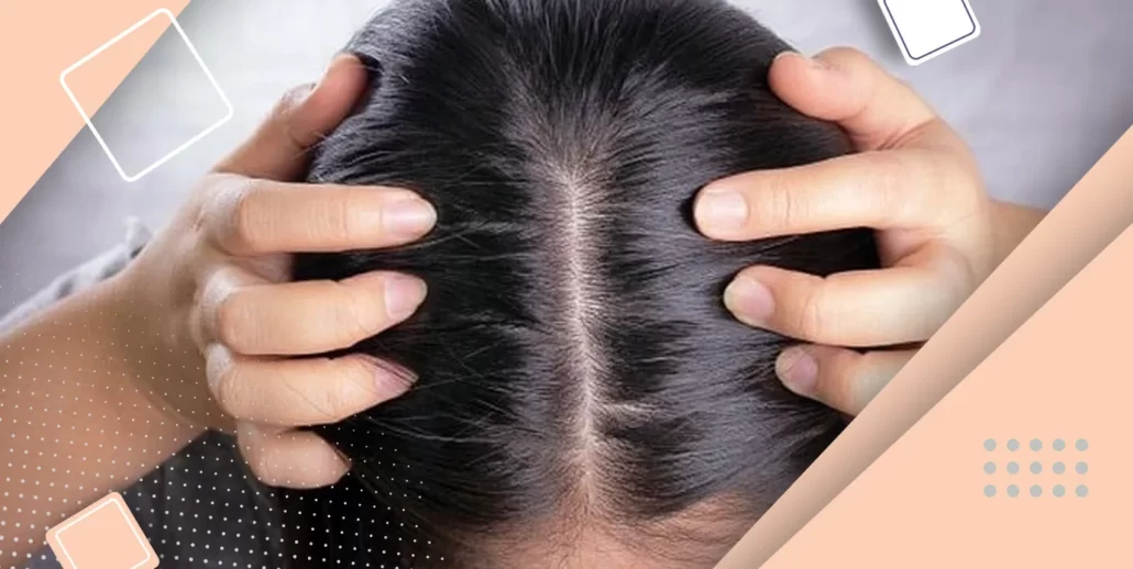 دلیلی چربی مو سر جیست؟