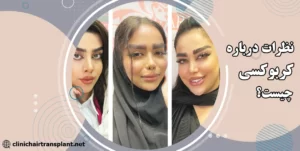 نطرات در مورد کربوکسی تراپی