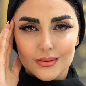 بعد از کاشت ابرو پر پشت