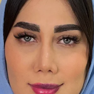 بعد از کاشت ابرو