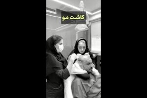 -مو-با-متد-میکروگرافت-poster