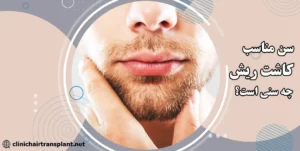 بهترین سن برای کاشت ریش