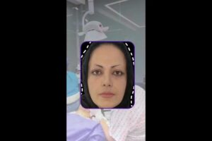 نتیجه-کاشت-ابرو-در-یک-جلسه-poster