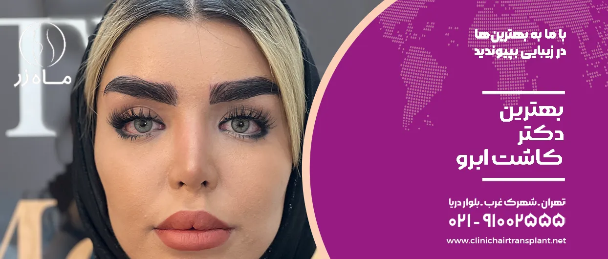 بهترین دکتر کاشت ابرو