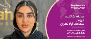 هزینه کاشت ابرو در سعادت آباد تهران
