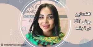 کاشت ابرو به روش fit