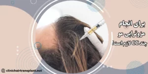 برای مزوتراپی مو چند سی سی لازم است؟