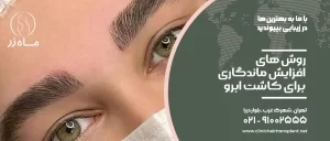 روش های افزایش ماندگاری کاشت ابرو