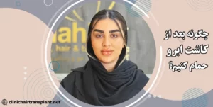 نحوه حمام بعد از کاشت ابرو چگونه است؟