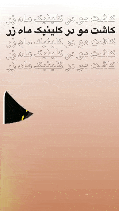 ماینوکسیدیل بعد از کاشت مو
