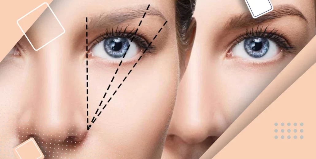 نمی توانند کاشت ابرو انجام دهند