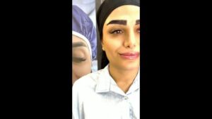 کاشت-ابرو-یک-جلسه‌ای-poster