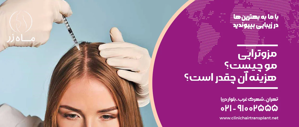 مزوتراپی مو چیست؟