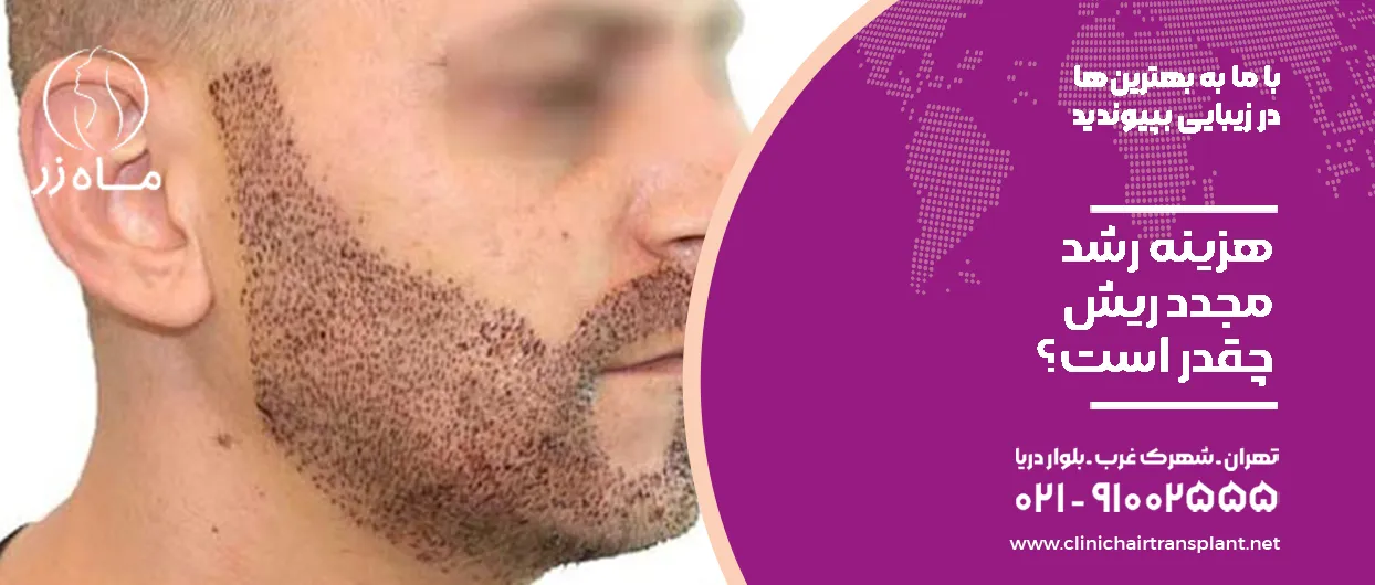 هزینه رشد مجدد ریش چقدر است؟