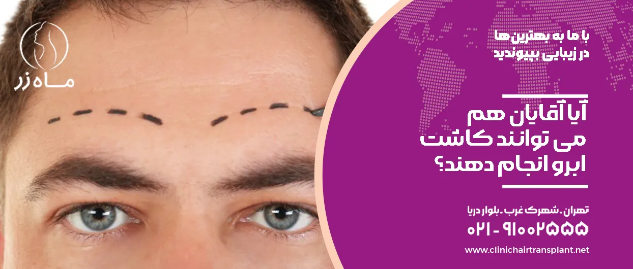 آیا آقایان هم می توانند کاشت ابرو انجام دهند؟