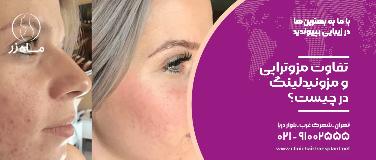 تفاوت مزوتراپی و مزونیدلینگ در چیست؟