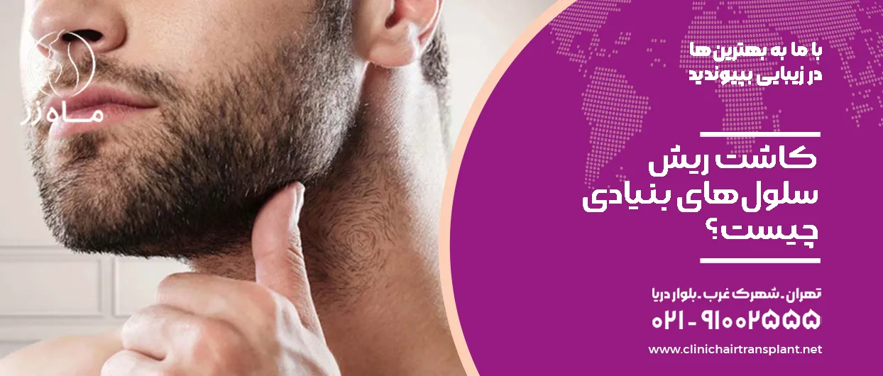 کاشت ریش سلولهای بنیادی چیست؟