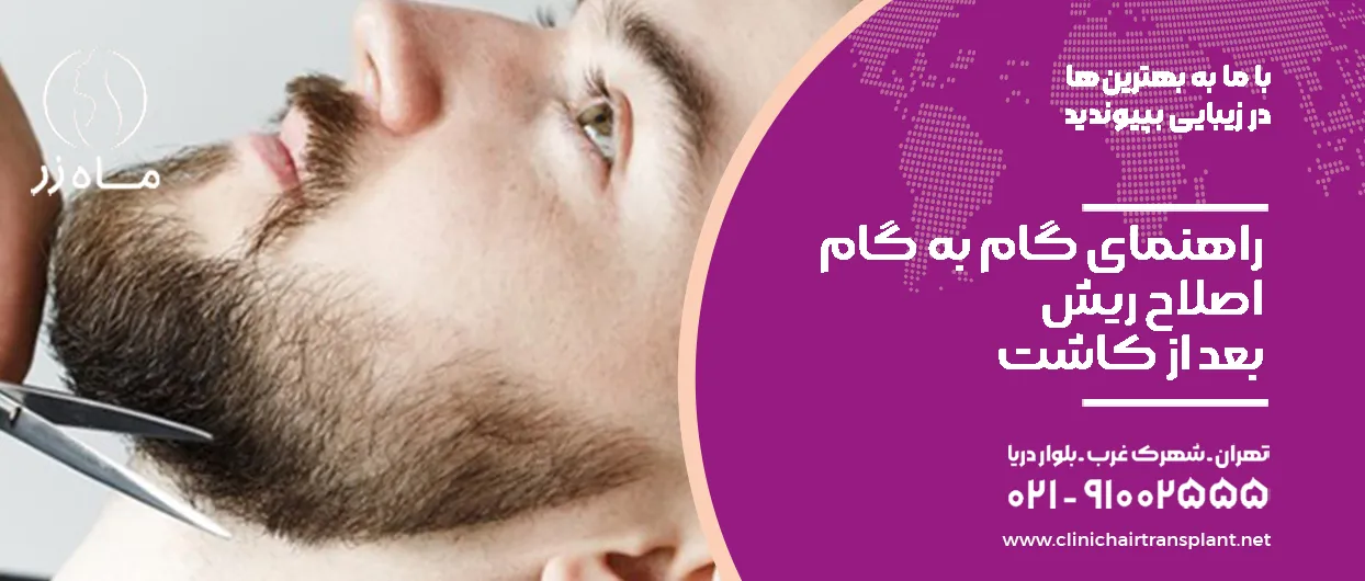 راهنمای گام به گام اصلاح ریش بعد از کاشت
