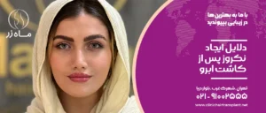 دلایل ایجاد نکروز پس از کاشت ابرو