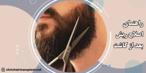 راهنمای اصلاح ریش بعد از کاشت