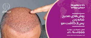روش‌‌های صحیح شانه زدن پس از کاشت مو