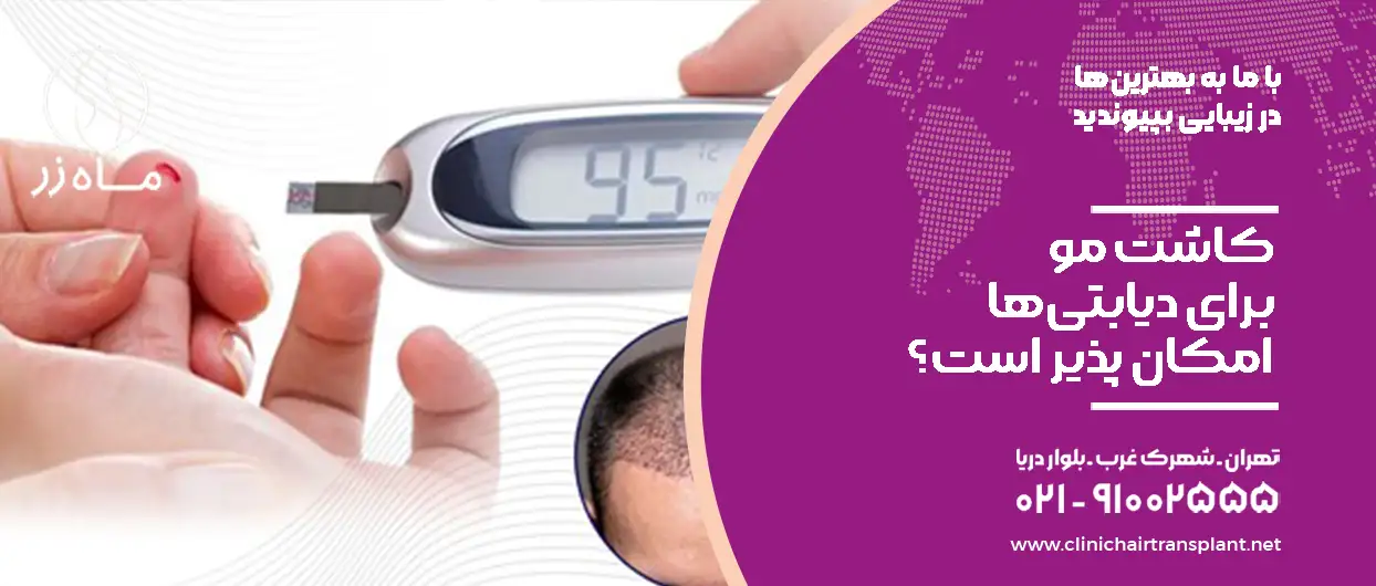 کاشت مو برای دیابتیها امکان پذیر است؟