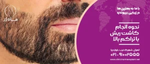 نحوه انجام کاشت ریش با تراکم بالا