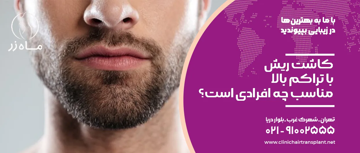 کاشت ریش با تراکم بالا مناسب چه افرادی است؟