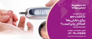 کاشت مو برای دیابتی‌ها امکان پذیر است؟