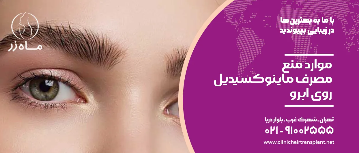 موارد منع مصرف ماینوکسیدیل روی ابرو