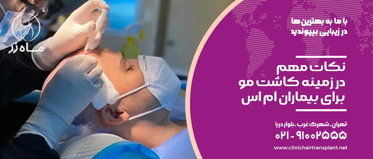 نکات مهم در زمینه کاشت مو برای بیماران ام اس
