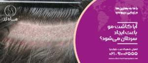 آیا کاشت مو باعث سرطان می‌‌شود؟