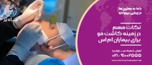 نکات مهم در زمینه کاشت مو برای بیماران ام اس