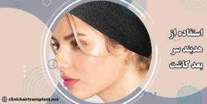 بستن هدبند بعد از کاشت ابرو