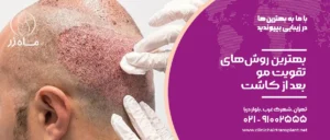 بهترین روش‌های تقویت مو بعد از کاشت