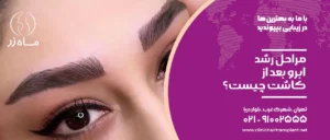 مراحل رشد ابرو بعد از کاشت چیست