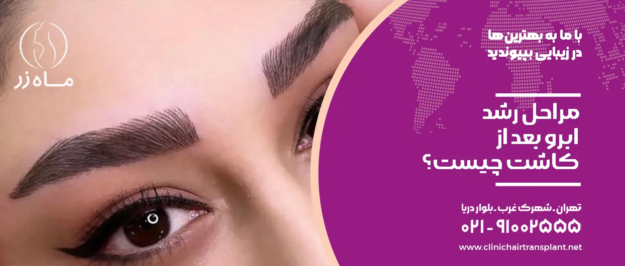 مراحل رشد ابرو بعد از کاشت چیست