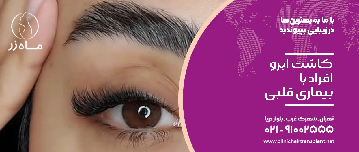 کاشت ابرو افراد با بیماری قلبی