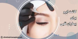 کاشت ابرو برای بیماران قلبی