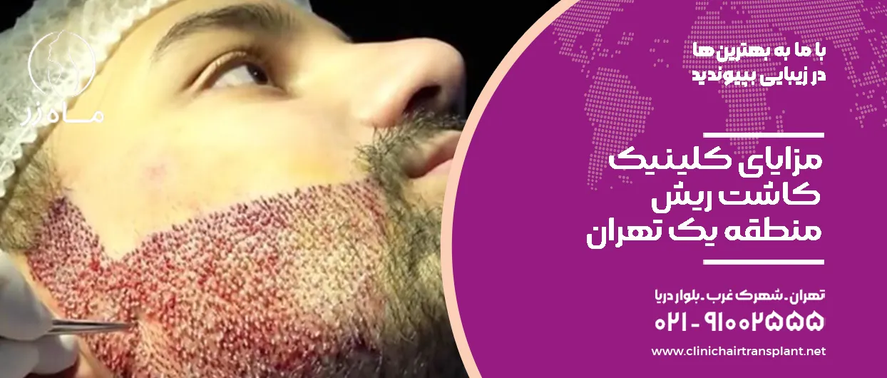 مزایای کلینیک کاشت ریش منطقه یک تهران